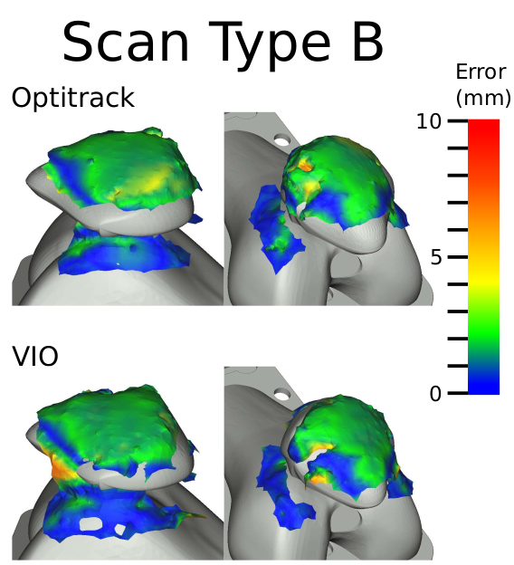 Ultrasound Device